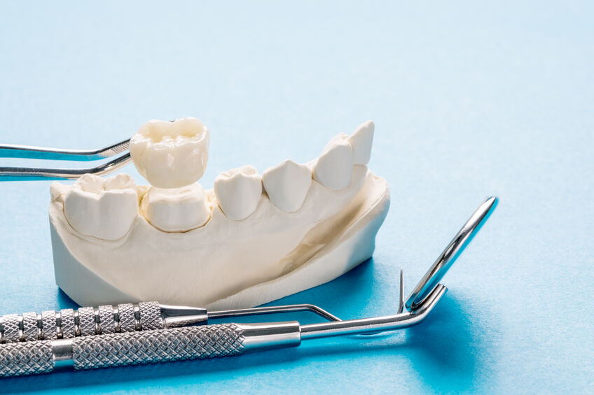 Closeup of Prosthodontics model